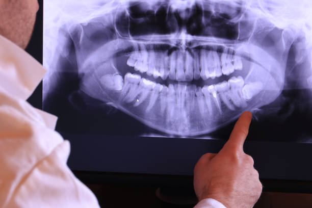 Best Tooth Infection Emergency Dentist  in Upper Arlington, OH