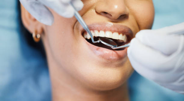Best Tooth Infection Emergency Dentist  in Upper Arlington, OH