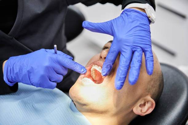 Best Emergency Tooth Extraction  in Upper Arlington, OH